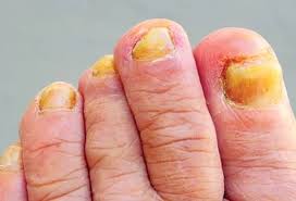 Foot and nail care illustration