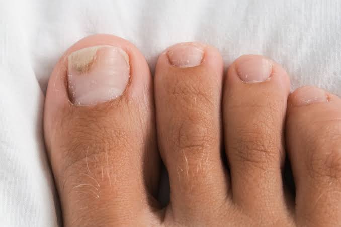 Foot and nail care illustration