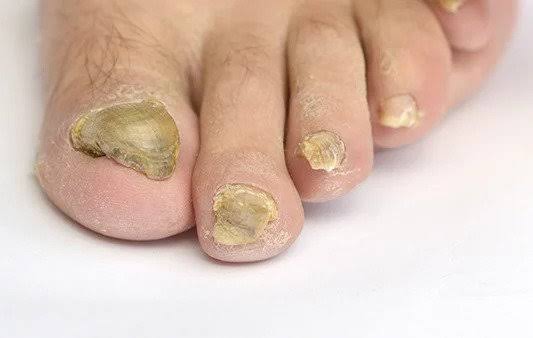 Foot and nail care illustration